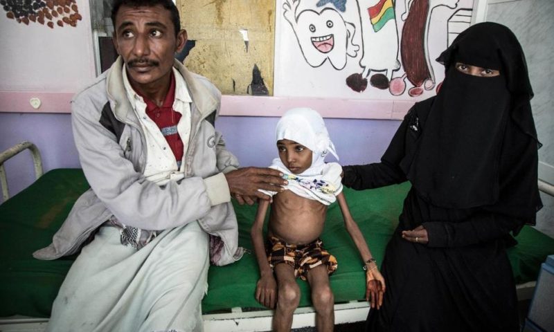 UN Says Civilian Casualties in Yemen Average 123 Per Week