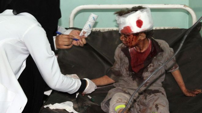 Yemen: Western powers may be held responsible for war crimes – UN
