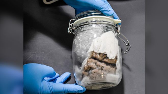 Human brain seized in mail truck on US-Canada border