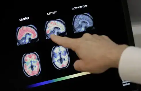 Can Chinese AI solve inequality? + How dementia comes for your bank account